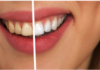 Why Visit the Dentist for A Healthy Smile – A Brief Guide