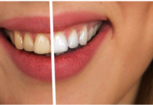 Why Visit the Dentist for A Healthy Smile – A Brief Guide