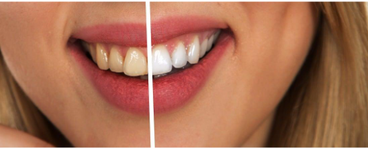 Why Visit the Dentist for A Healthy Smile – A Brief Guide